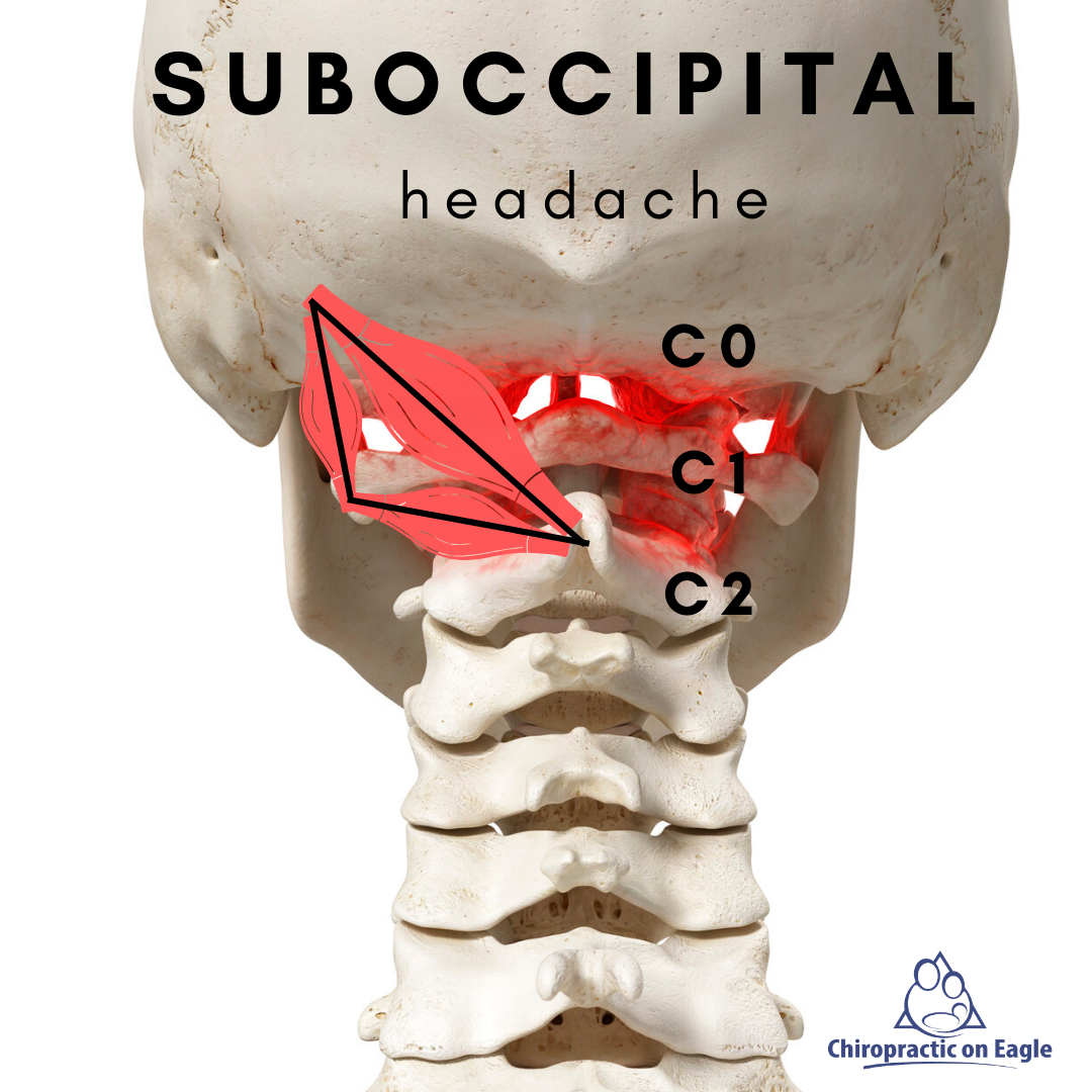 suboccipital headache